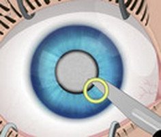 Eye Surgery